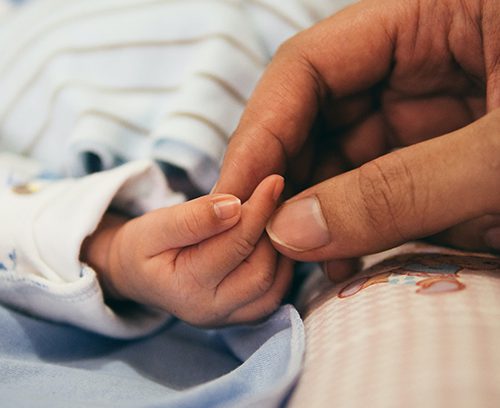 Baby with Jaundice after Transcutanous Bilirubin screening